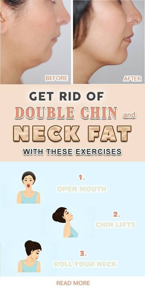 How to Lose Neck Fat