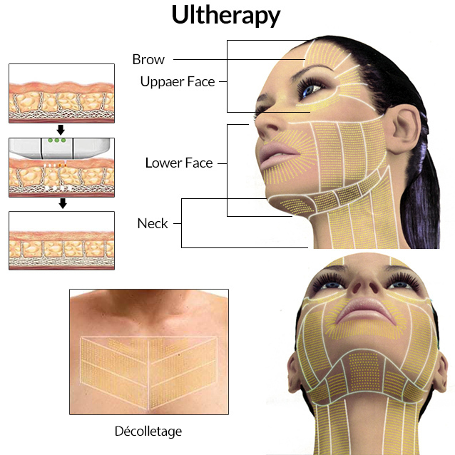 Exercises for Neck Fat